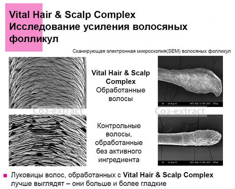  Vital hair & scalp complex  